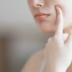 5 Cara Mencegah dan Mengatasi Kulit Kering Secara Alami