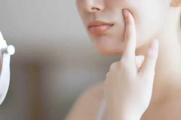 5 Cara Mencegah dan Mengatasi Kulit Kering Secara Alami 5 Cara Mencegah dan Mengatasi Kulit Kering Secara Alami