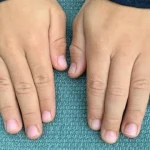 Panduan Merawat Kuku untuk Anak-anak: 5 Tips Dasar