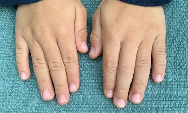 Panduan Merawat Kuku untuk Anak-anak: 5 Tips Dasar