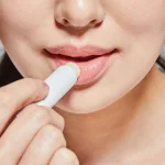 7 Cara Menghindari Bibir Terbakar Matahari