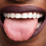 10 Penyebab Lidah Kesemutan dan Cara Menghindarinya