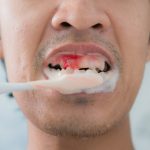 10 Kesalahan Merawat Gigi yang Sering Dilakukan