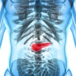 5 Tips Menghindari Konsumsi Alkohol demi Pankreas Sehat