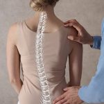 5 Tips Menghindari Skoliosis Sejak Dini