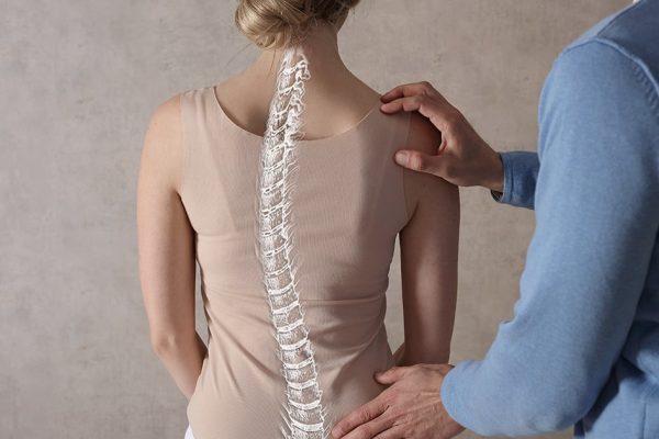 5 Tips Menghindari Skoliosis Sejak Dini 5 Tips Menghindari Skoliosis Sejak Dini