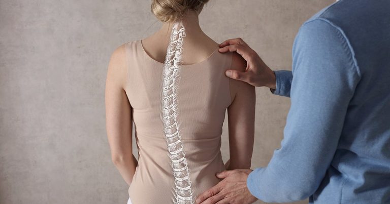 5 Tips Menghindari Skoliosis Sejak Dini