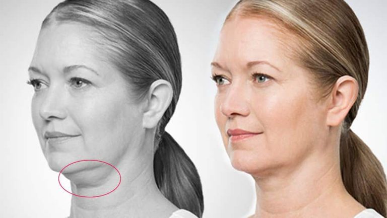 5 Perawatan Dagu untuk Lansia: 7 Langkah Mudah di Rumah