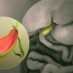 10 Tips Menjaga Kantong Empedu Tetap Sehat di Tengah Polusi