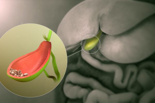10 Tips Menjaga Kantong Empedu Tetap Sehat di Tengah Polusi