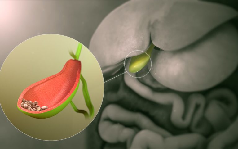 10 Tips Menjaga Kantong Empedu Tetap Sehat di Tengah Polusi